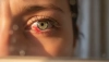 # Zjistěte proč nám praskají cévky v očích

*(Erfahren Sie, warum uns die Äderchen in den Augen plat